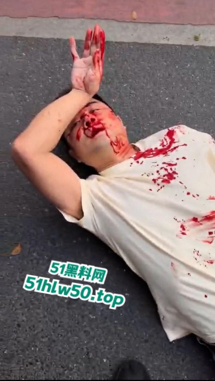 广东潮汕暴躁男在线作死，只因未戴头盔强行躲检撞飞交警双双倒地不起满脸是伤！